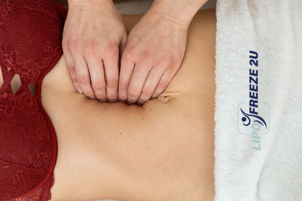 diastasis recti treatment Cheshire