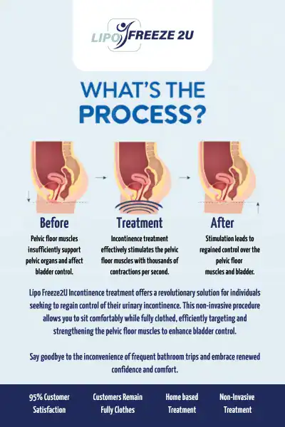 Diagram of how incontinence treatment Cheshire works.