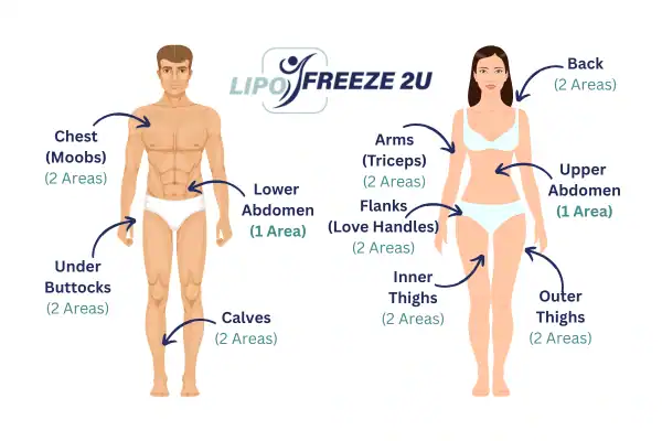 Areas you can have fat freezing treatment Cheshire