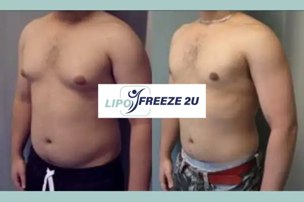 How Long Does It Take to See Results Cheshire?