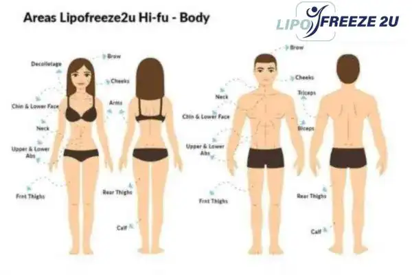 image of areas of the body and HIFU prices Cheshire