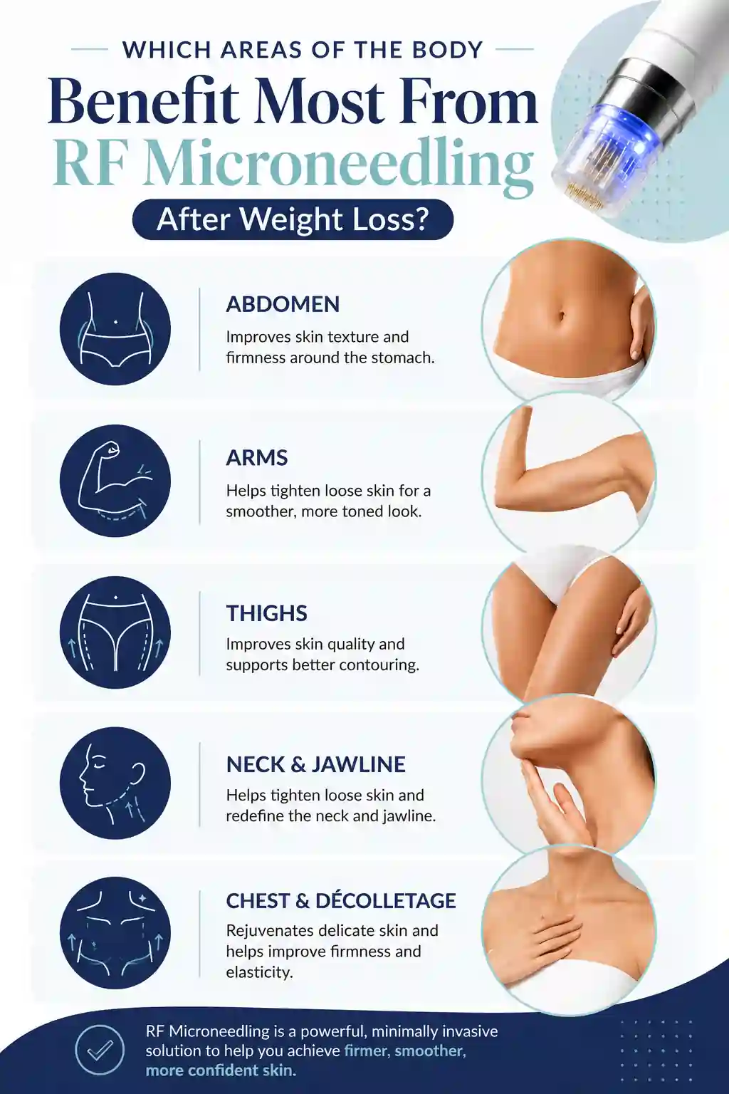 Which Areas of the Body Benefit Most From RF Microneedling After Weight Loss Cheshire